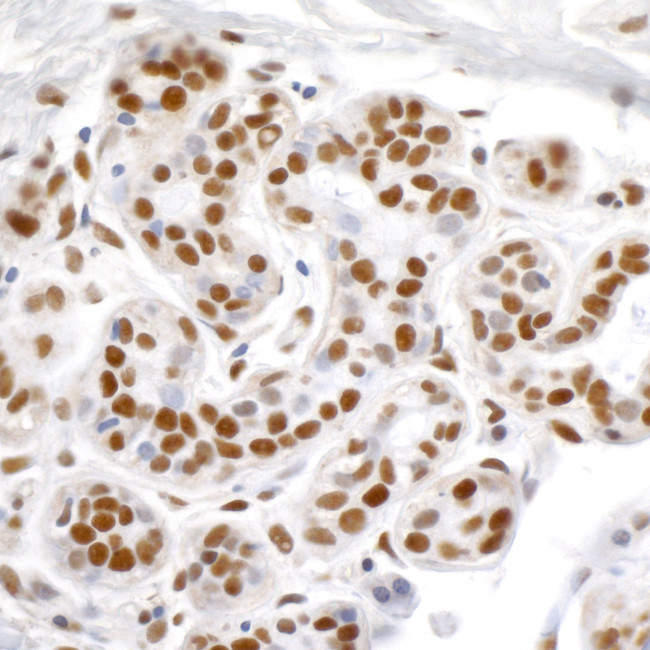 KAP-1 Antibody in Immunohistochemistry (Paraffin) (IHC (P))