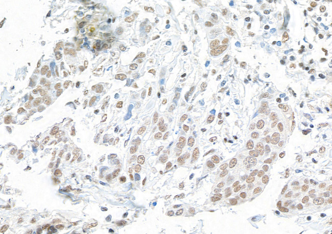 SMAR1/BANP Antibody in Immunohistochemistry (Paraffin) (IHC (P))