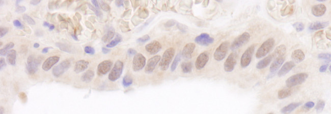 Rad6 Antibody in Immunohistochemistry (Paraffin) (IHC (P))