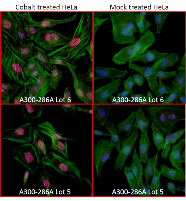 HIF1-alpha Antibody in Immunocytochemistry (ICC/IF)