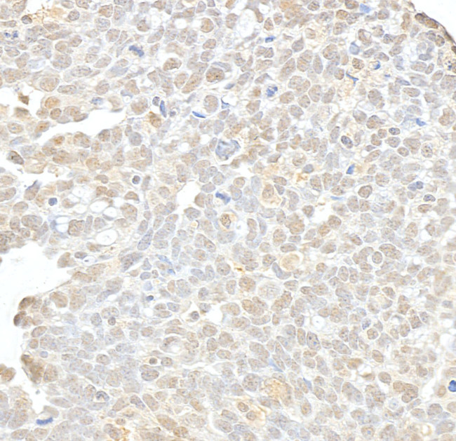 hSET1 Antibody in Immunohistochemistry (Paraffin) (IHC (P))