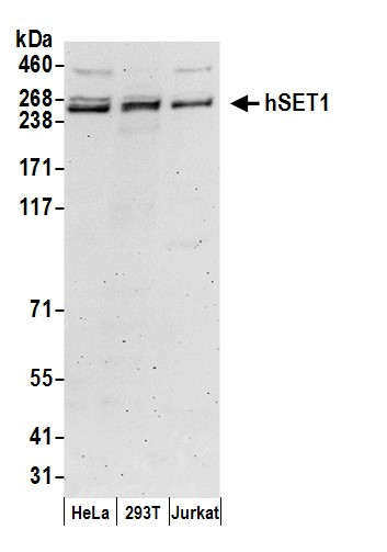 hSET1 Antibody in Western Blot (WB)