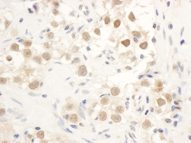 Chk1 Antibody in Immunohistochemistry (Paraffin) (IHC (P))