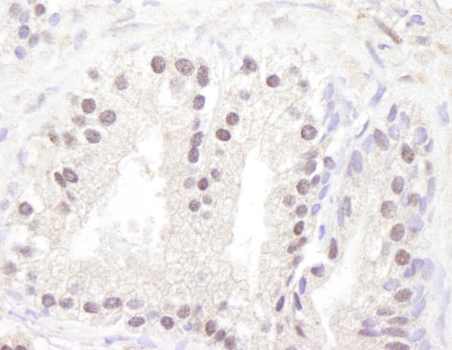 ATM Antibody in Immunohistochemistry (Paraffin) (IHC (P))