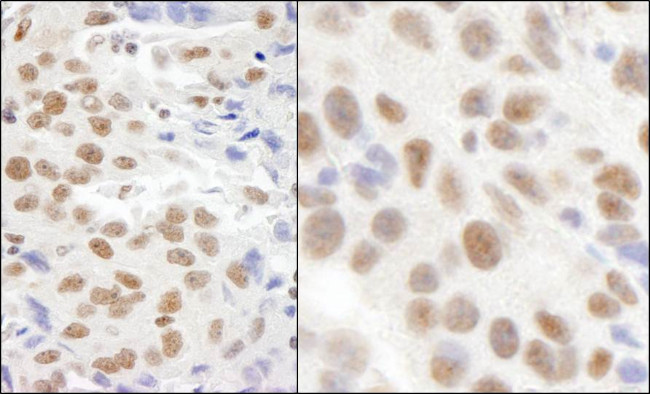 KIAA0082 Antibody in Immunohistochemistry (Paraffin) (IHC (P))