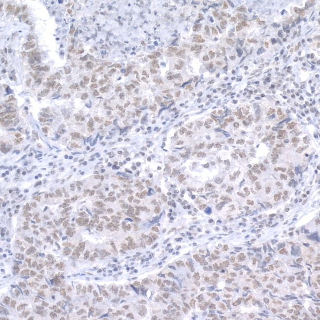 RAP1 Antibody in Immunohistochemistry (Paraffin) (IHC (P))