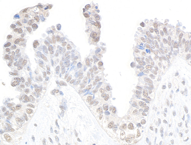 CDK11 Antibody in Immunohistochemistry (Paraffin) (IHC (P))