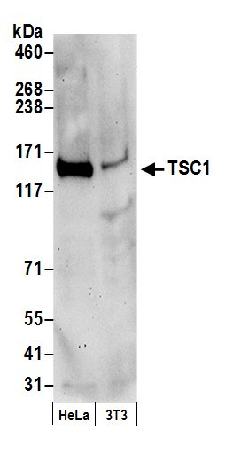 TSC1 Antibody in Western Blot (WB)