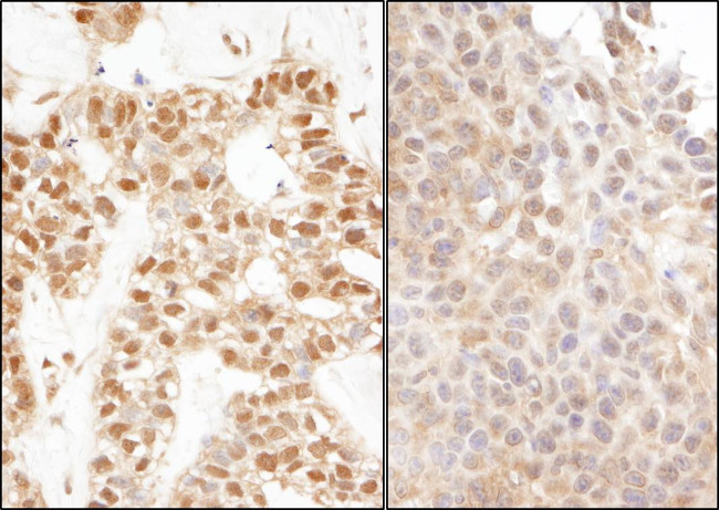 Ubiquitin Antibody in Immunohistochemistry (Paraffin) (IHC (P))