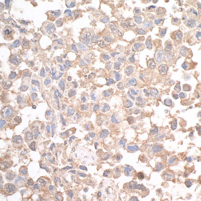 JLP Antibody in Immunohistochemistry (Paraffin) (IHC (P))