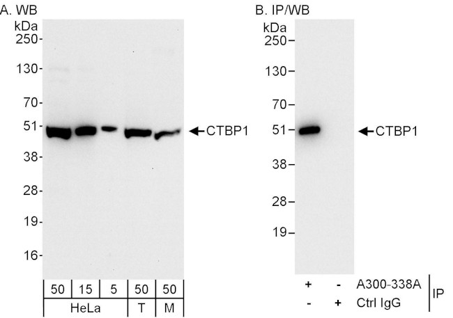 CTBP1 Antibody in Western Blot (WB)