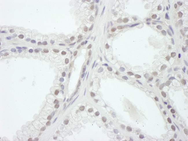 SRC1 Antibody in Immunohistochemistry (Paraffin) (IHC (P))