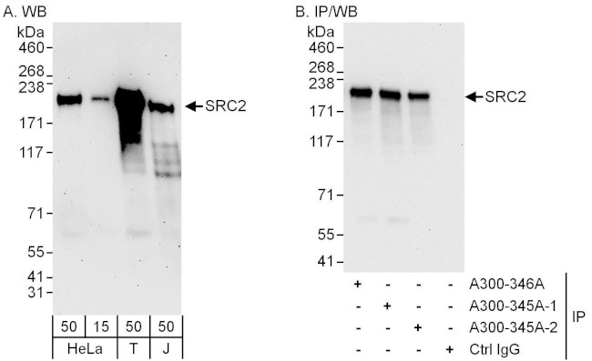 NCOA2/SRC2 Antibody in Western Blot (WB)