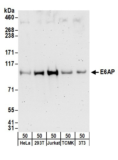 E6AP Antibody in Western Blot (WB)