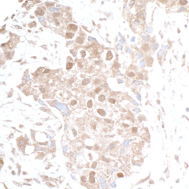 p300 Antibody in Immunohistochemistry (Paraffin) (IHC (P))