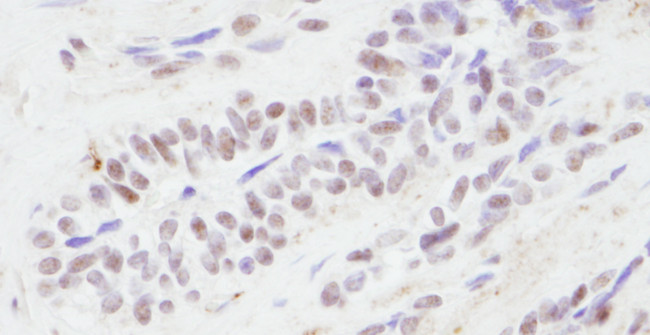 CBP Antibody in Immunohistochemistry (Paraffin) (IHC (P))