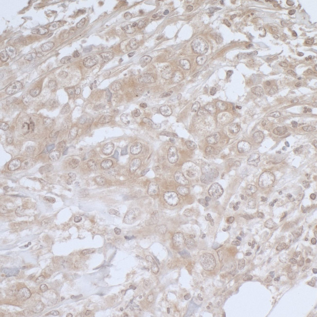 BIRC6/Apollon Antibody in Immunohistochemistry (Paraffin) (IHC (P))