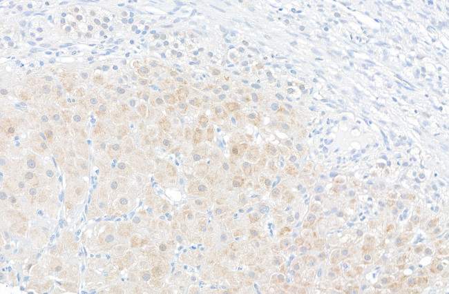 PBEF Antibody in Immunohistochemistry (Paraffin) (IHC (P))