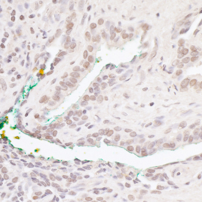 Bcl11b Antibody in Immunohistochemistry (Paraffin) (IHC (P))