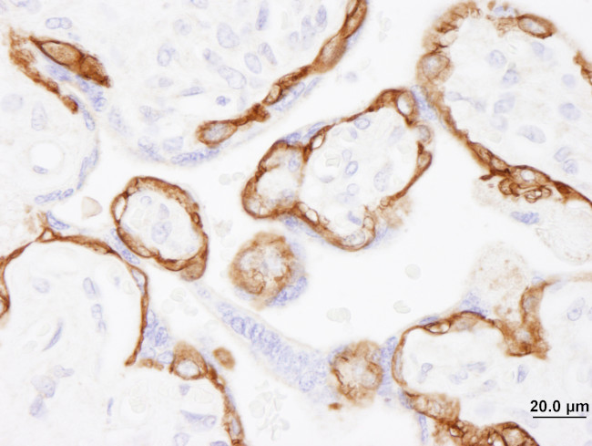 EGFR Antibody in Immunohistochemistry (Paraffin) (IHC (P))