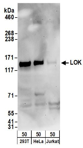 LOK Antibody in Western Blot (WB)