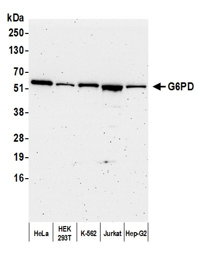 G6PD Antibody in Western Blot (WB)