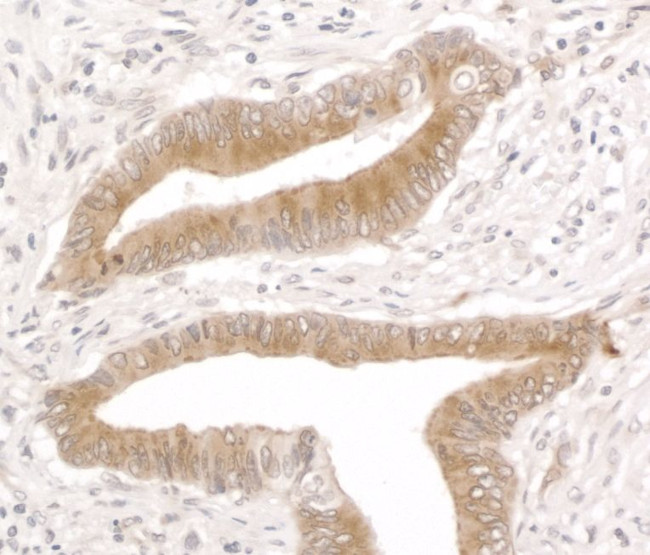 Reticulocalbin-1 Antibody in Immunohistochemistry (Paraffin) (IHC (P))