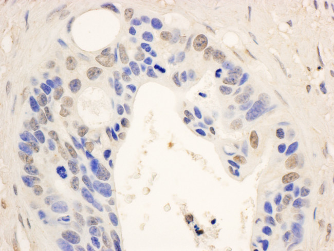 STAT6 Antibody in Immunohistochemistry (Paraffin) (IHC (P))