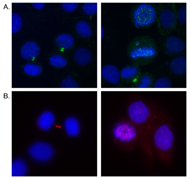 Aurora B Antibody in Immunocytochemistry (ICC/IF)