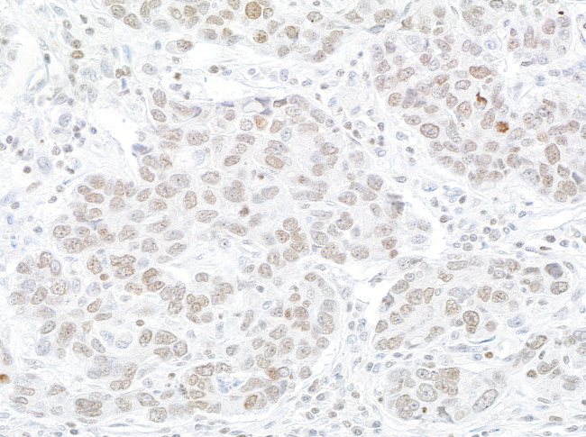 WSTF Antibody in Immunohistochemistry (Paraffin) (IHC (P))