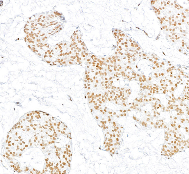 RecQ1 Antibody in Immunohistochemistry (Paraffin) (IHC (P))