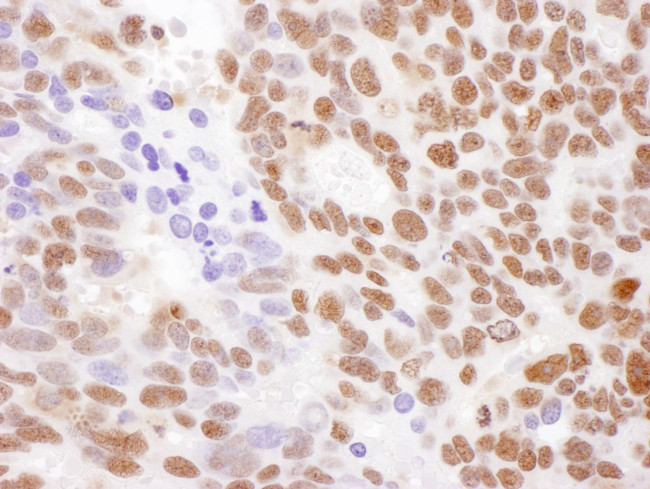 RecQ1 Antibody in Immunohistochemistry (Paraffin) (IHC (P))