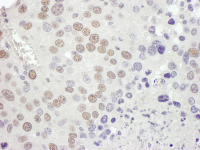 MSH2 Antibody in Immunohistochemistry (Paraffin) (IHC (P))