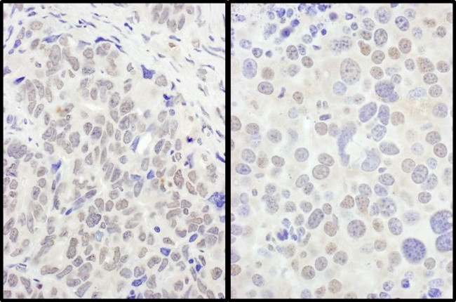 FOXO3a Antibody in Immunohistochemistry (Paraffin) (IHC (P))