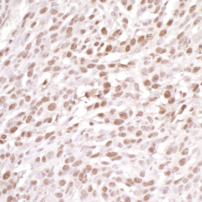 DDB1 Antibody in Immunohistochemistry (Paraffin) (IHC (P))