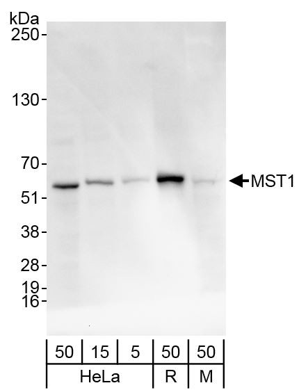 MST1/STK4 Antibody in Western Blot (WB)