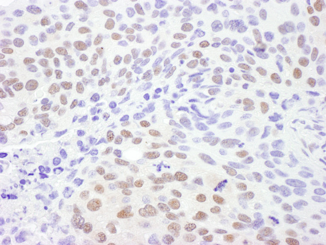 CRM1 Antibody in Immunohistochemistry (Paraffin) (IHC (P))