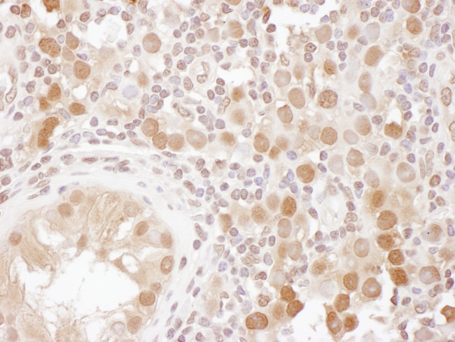 CSE1 Antibody in Immunohistochemistry (Paraffin) (IHC (P))