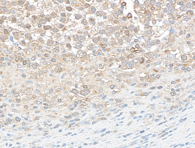 DDX3 Antibody in Immunohistochemistry (Paraffin) (IHC (P))