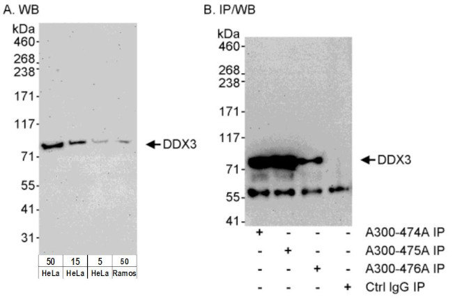 DDX3 Antibody in Western Blot (WB)