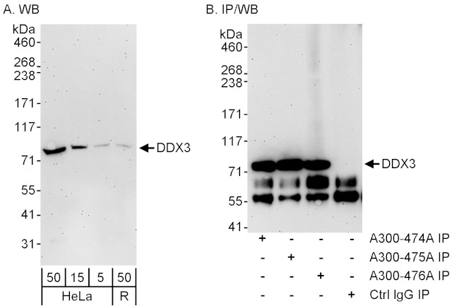 DDX3 Antibody in Western Blot (WB)