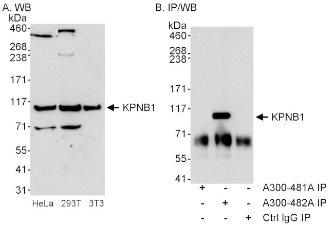 KPNB1 Antibody in Western Blot (WB)