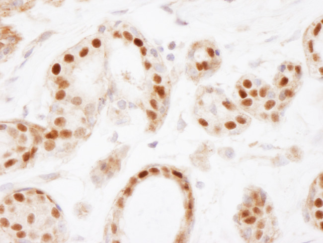 Estrogen Receptor Alpha Antibody in Immunohistochemistry (Paraffin) (IHC (P))