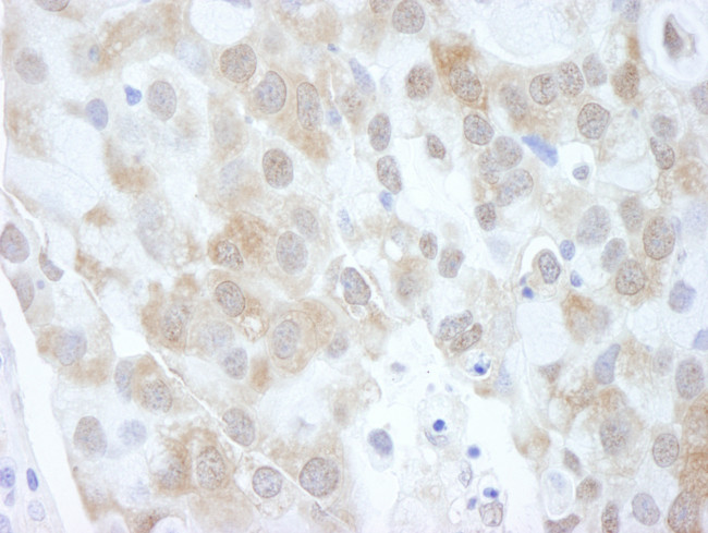 4EBP1 Antibody in Immunohistochemistry (Paraffin) (IHC (P))