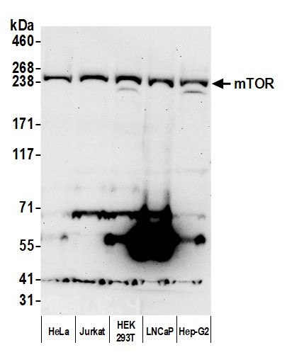 mTOR Antibody in Western Blot (WB)