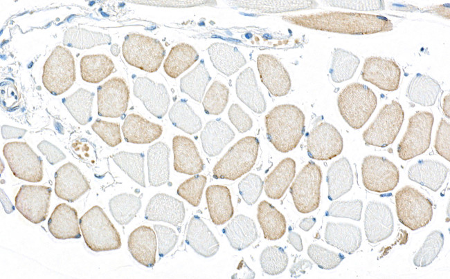 AMPK alpha 1 Antibody in Immunohistochemistry (Paraffin) (IHC (P))