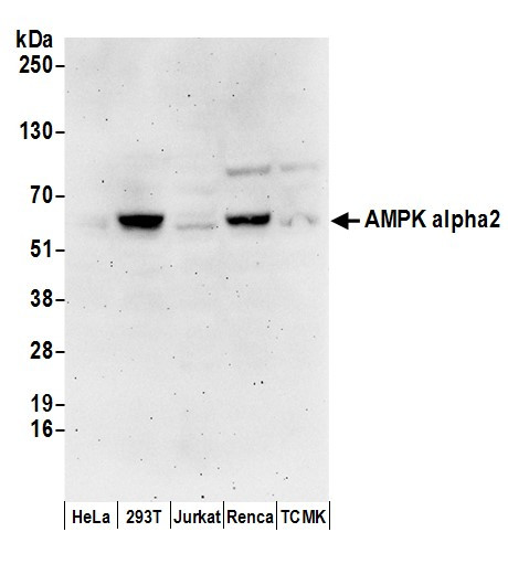 AMPK alpha 2 Antibody in Western Blot (WB)