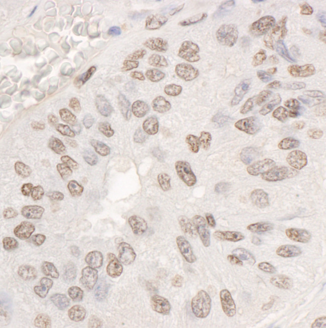 DDX17 Antibody in Immunohistochemistry (Paraffin) (IHC (P))