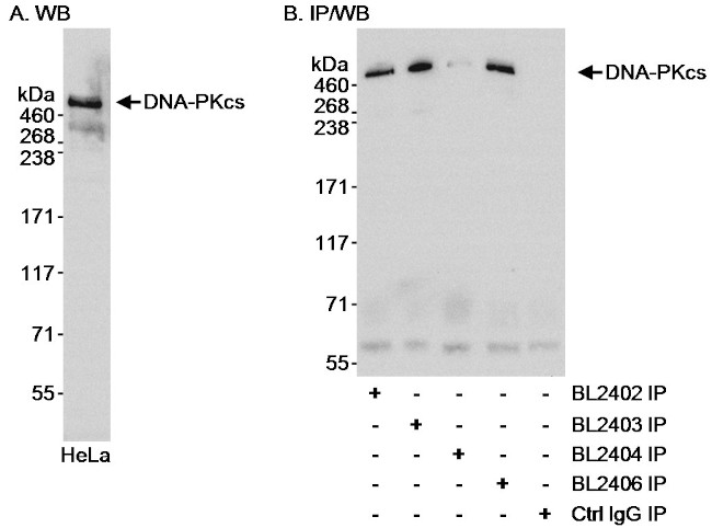 DNA-PKcs Antibody in Western Blot (WB)