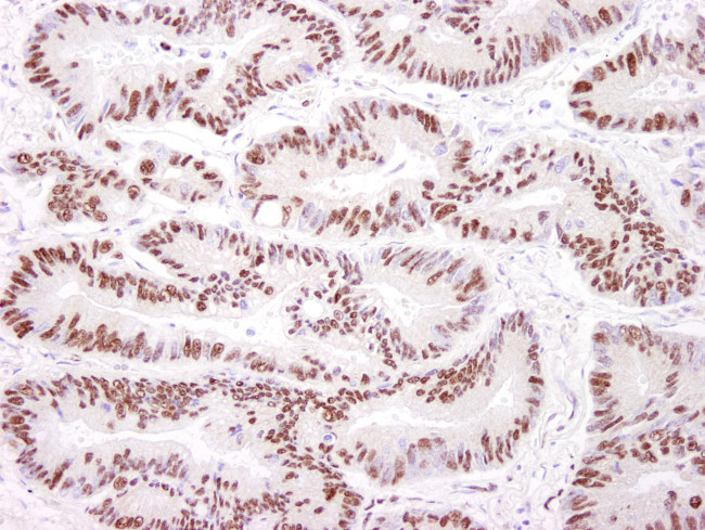 DNA-PKcs Antibody in Immunohistochemistry (Paraffin) (IHC (P))